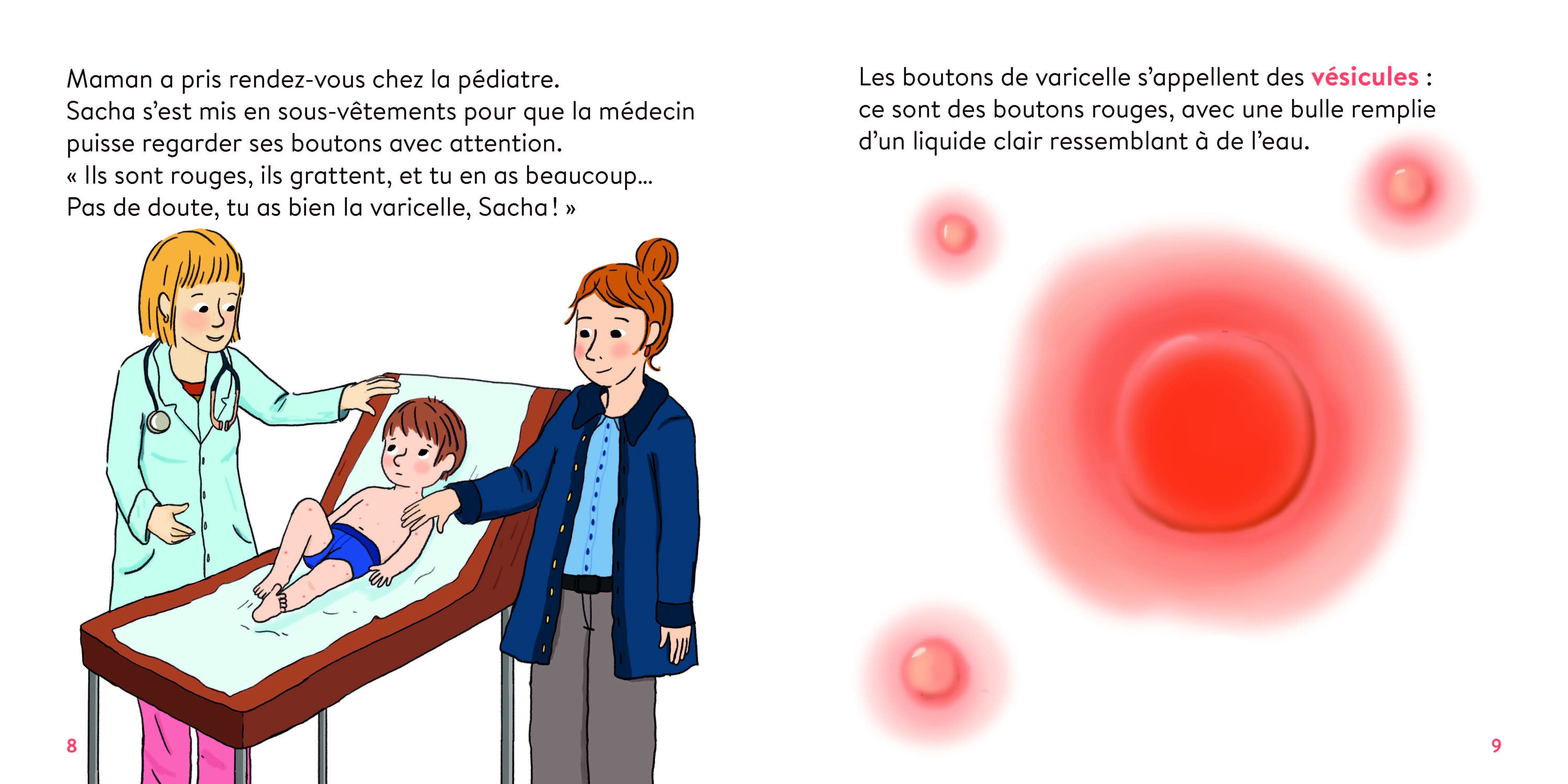 LA VARICELLE